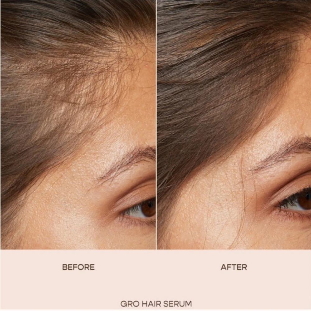 *SEALED* Vegamour GRO Hair Serum - Picture 6 of 11